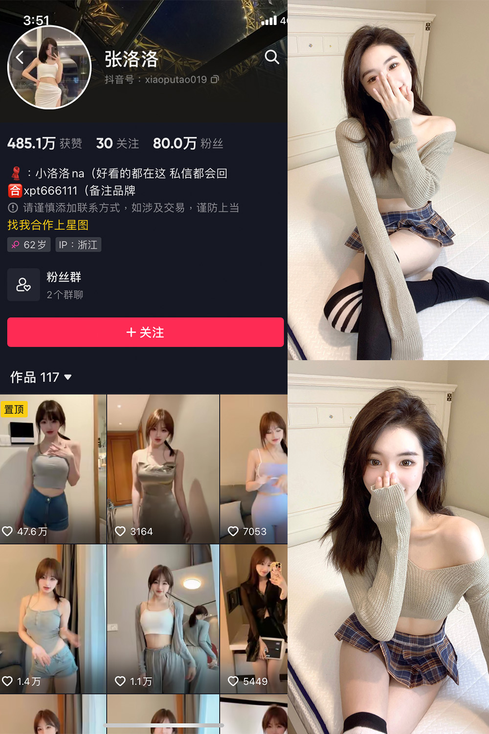 张洛洛 微密圈 NO.002期预览图 1 张洛洛 微密圈 NO.002期预览图 1